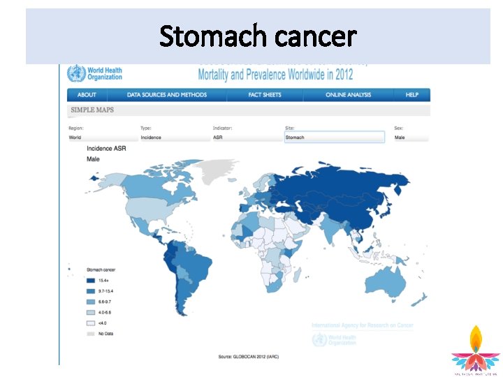 Stomach cancer 