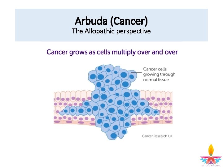 Arbuda (Cancer) The Allopathic perspective 