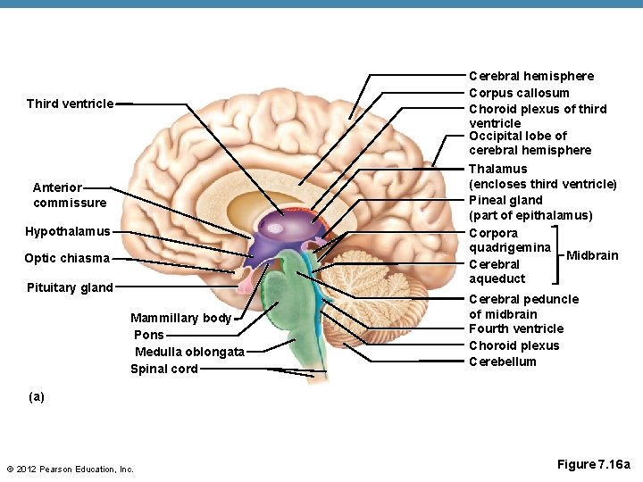 Cerebral hemisphere Corpus callosum Choroid plexus of third ventricle Occipital lobe of cerebral hemisphere