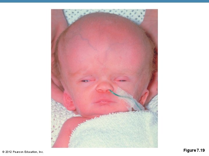 © 2012 Pearson Education, Inc. Figure 7. 19 