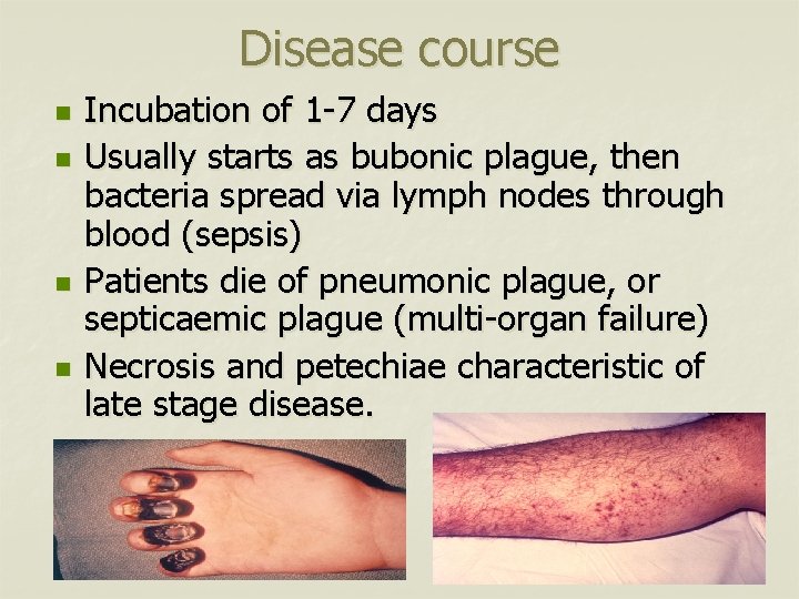 Disease course n n Incubation of 1 -7 days Usually starts as bubonic plague,