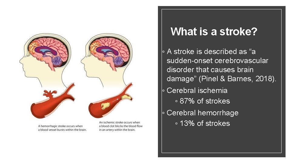 What is a stroke? ◦ A stroke is described as “a sudden-onset cerebrovascular disorder