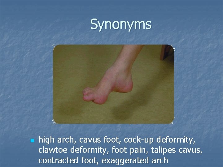 Synonyms n high arch, cavus foot, cock-up deformity, clawtoe deformity, foot pain, talipes cavus,