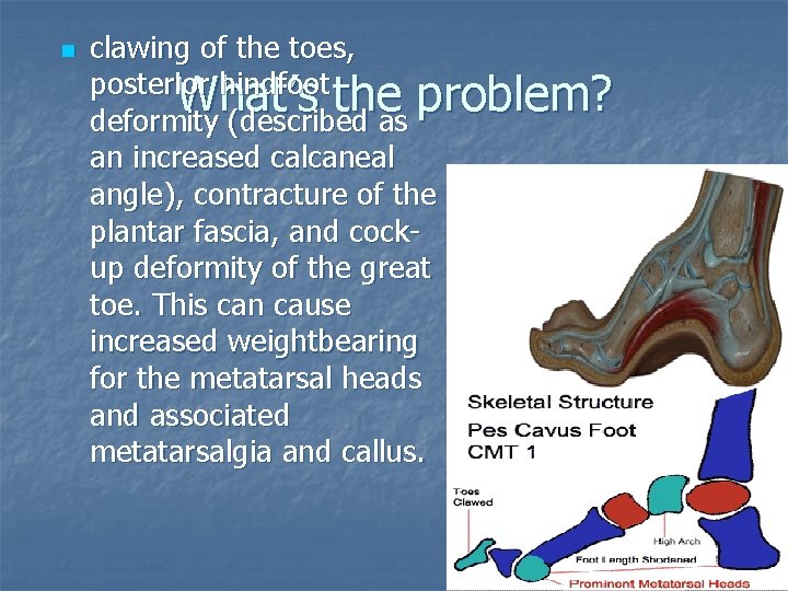 n clawing of the toes, posterior hindfoot What’s the problem? deformity (described as an