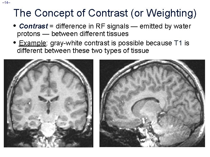 – 14– The Concept of Contrast (or Weighting) • Contrast = difference in RF
