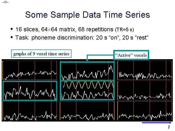 – 18– Some Sample Data Time Series • 16 slices, 64 64 matrix, 68