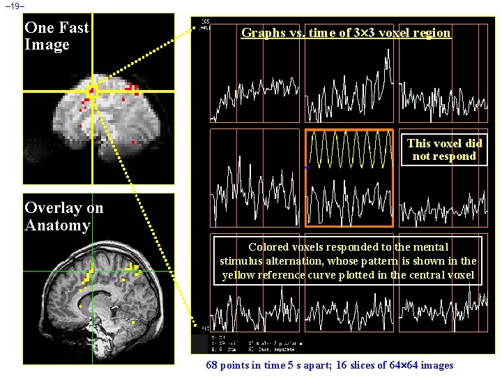 – 19– One Fast Image Graphs vs. time of 3 3 voxel region This