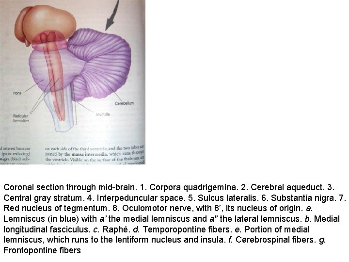 Coronal section through mid-brain. 1. Corpora quadrigemina. 2. Cerebral aqueduct. 3. Central gray stratum.