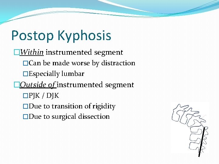 Postop Kyphosis �Within instrumented segment �Can be made worse by distraction �Especially lumbar �Outside