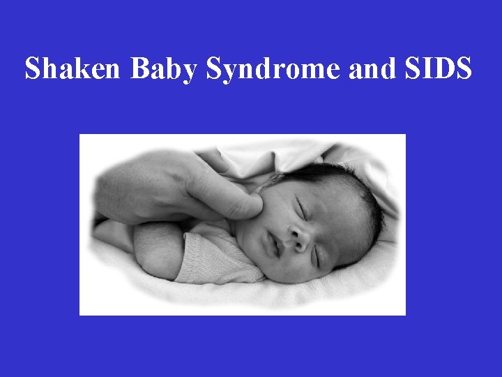 Shaken Baby Syndrome and SIDS 