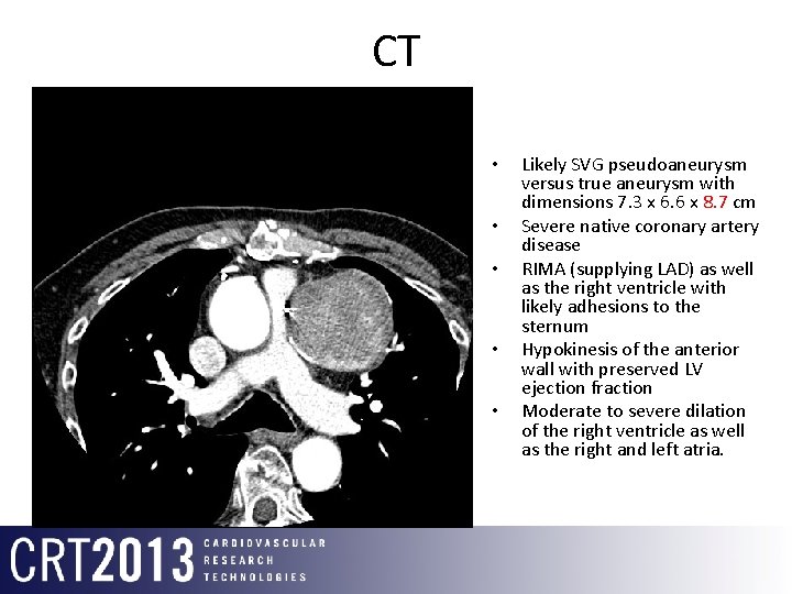 CT • • • Likely SVG pseudoaneurysm versus true aneurysm with dimensions 7. 3