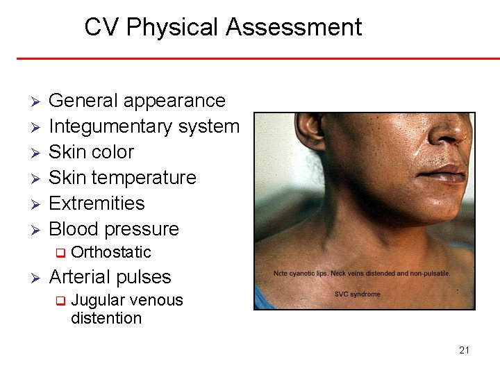 CV Physical Assessment Ø Ø Ø General appearance Integumentary system Skin color Skin temperature