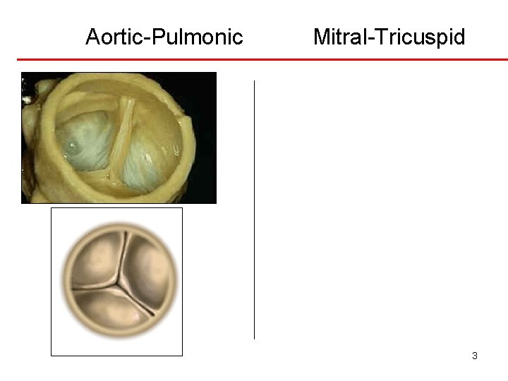 Aortic-Pulmonic Mitral-Tricuspid 3 