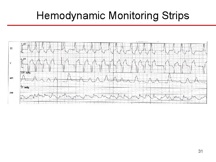 Hemodynamic Monitoring Strips 31 