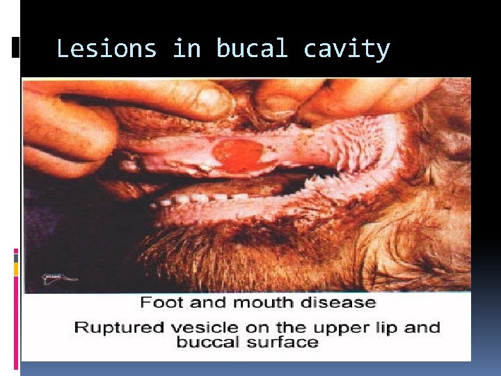 Lesions in bucal cavity 