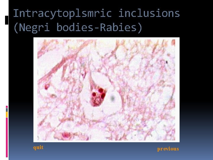 Intracytoplsmric inclusions (Negri bodies-Rabies) quit previous 