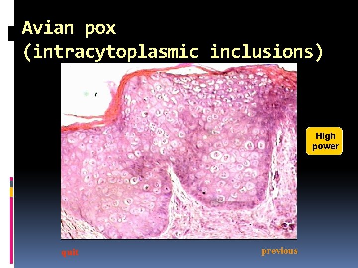 Avian pox (intracytoplasmic inclusions) High power quit previous 