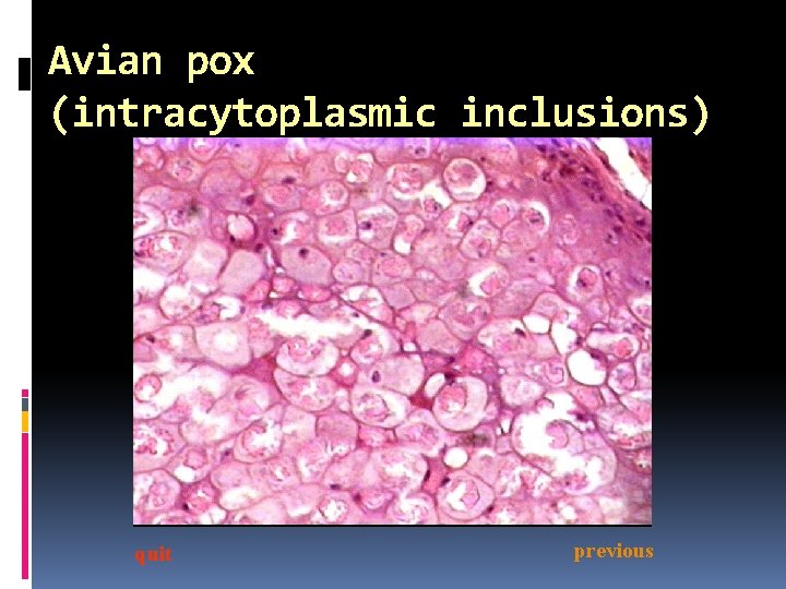 Avian pox (intracytoplasmic inclusions) quit previous 