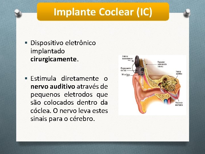 Implante Coclear (IC) § Dispositivo eletrônico implantado cirurgicamente. § Estimula diretamente o nervo auditivo