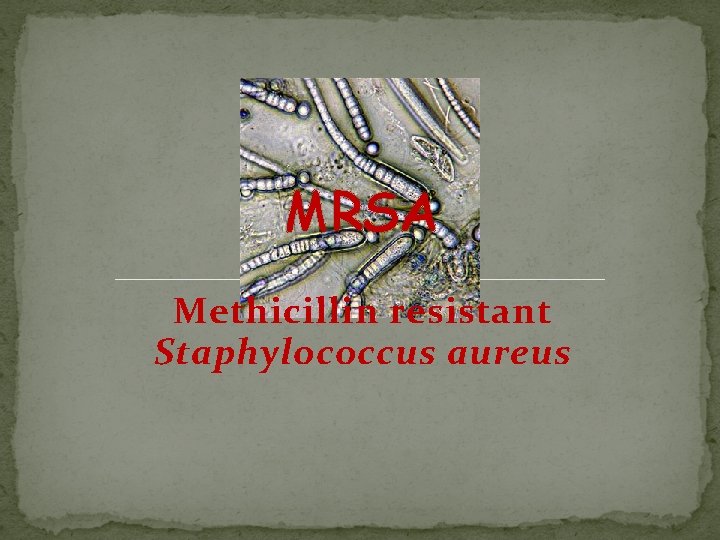 MRSA Methicillin resistant Staphylococcus aureus 