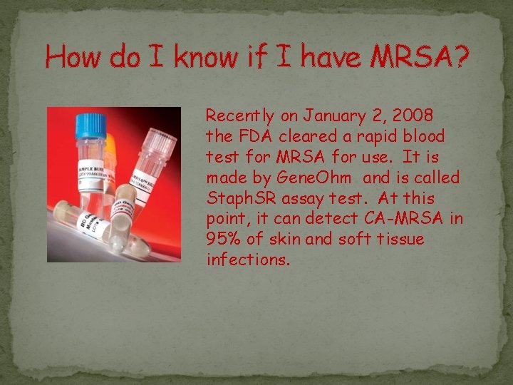 How do I know if I have MRSA? Recently on January 2, 2008 the