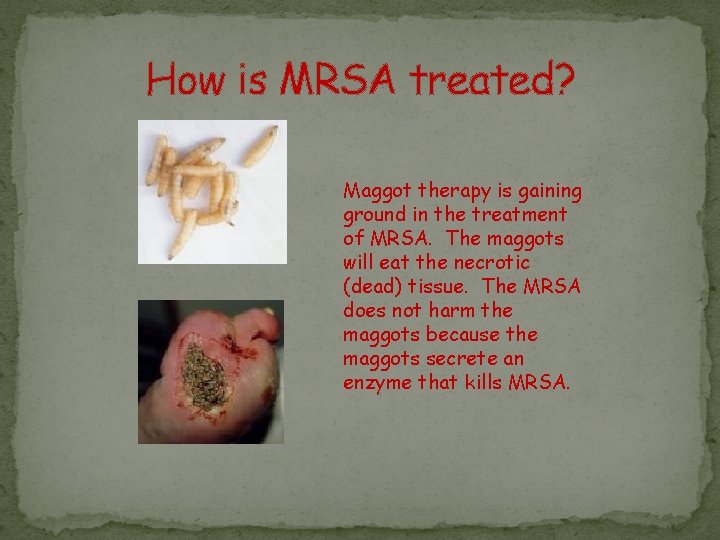 How is MRSA treated? Maggot therapy is gaining ground in the treatment of MRSA.