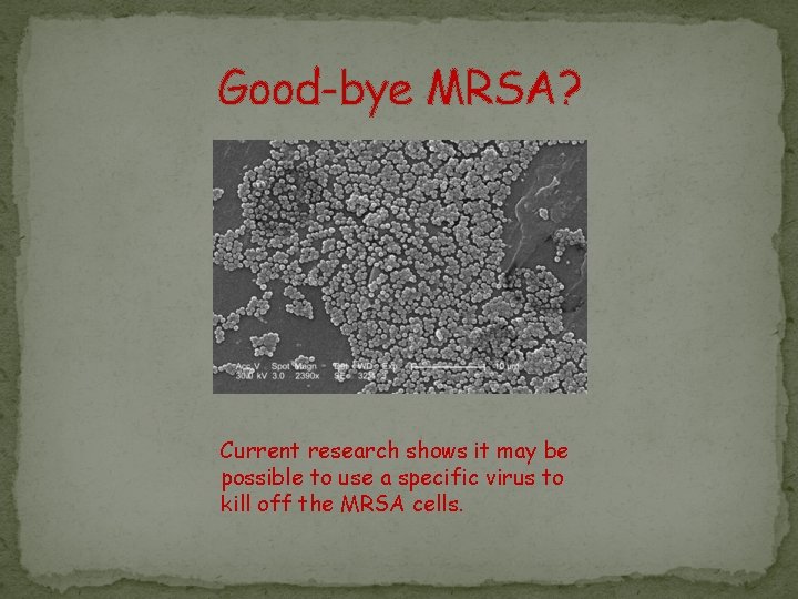 Good-bye MRSA? Current research shows it may be possible to use a specific virus