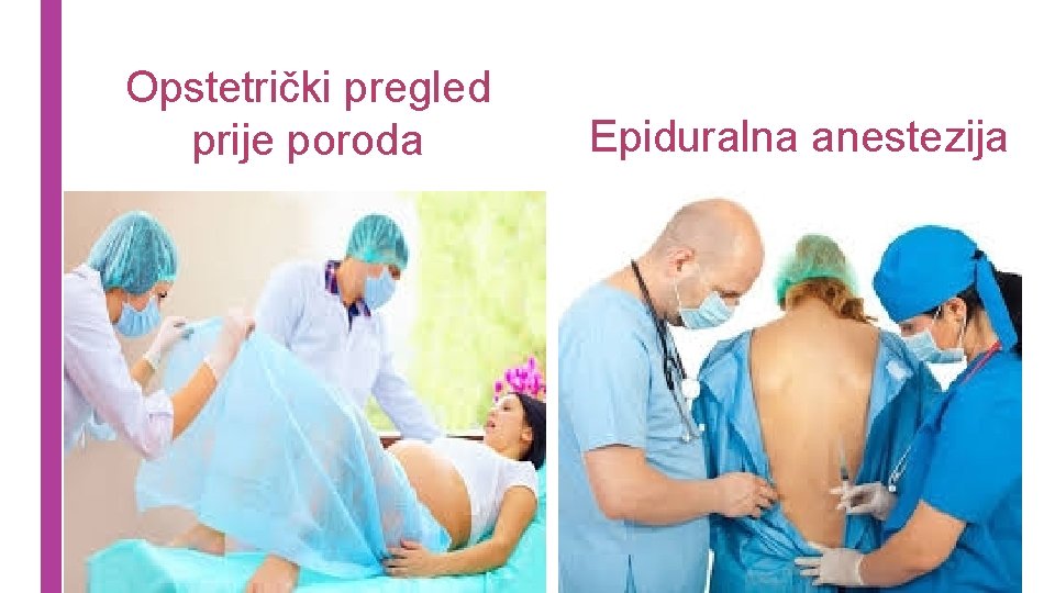 Opstetrički pregled prije poroda Epiduralna anestezija 