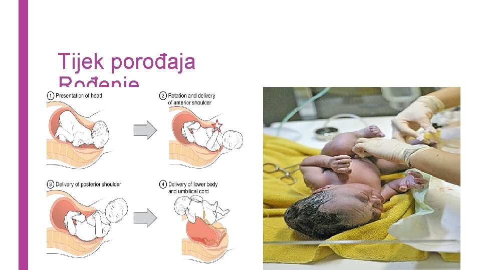 Tijek porođaja Rođenje 