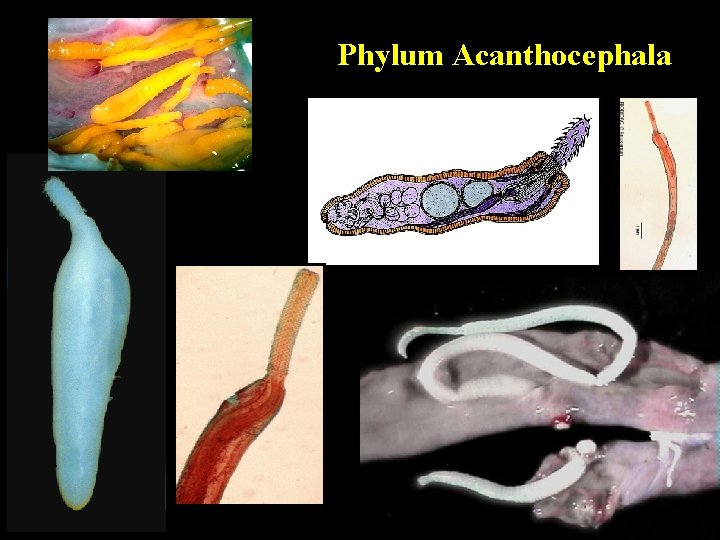 Phylum Acanthocephala 