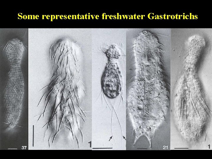 Some representative freshwater Gastrotrichs 