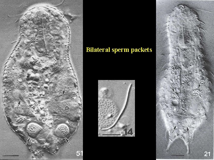 Bilateral sperm packets 