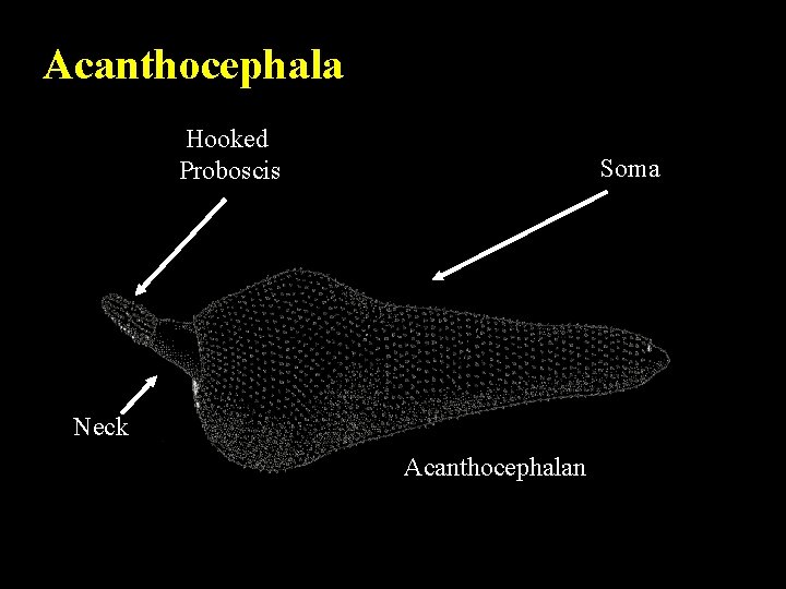 Acanthocephala Hooked Proboscis Soma Neck Acanthocephalan 