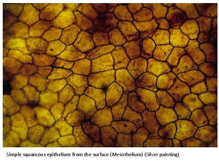 Simple squamous epithelium from the surface (Mesothelium) (Silver painting) 