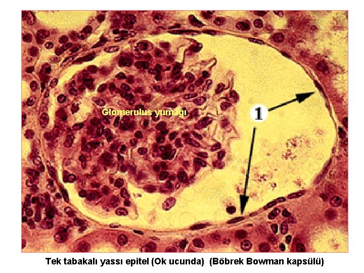 Glomerulus yumağı Tek tabakalı yassı epitel (Ok ucunda) (Böbrek Bowman kapsülü) 