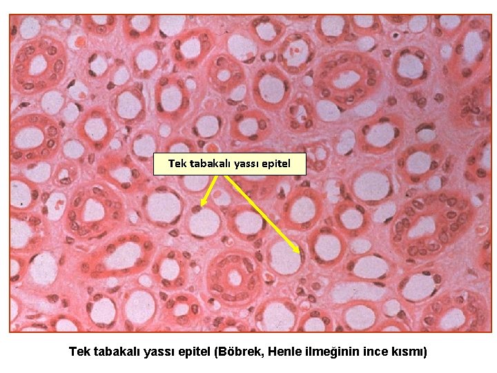 Tek tabakalı yassı epitel (Böbrek, Henle ilmeğinin ince kısmı) 