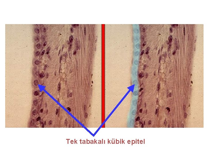 Tek tabakalı kübik epitel 