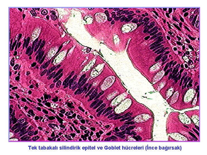 Tek tabakalı silindirik epitel ve Goblet hücreleri (İnce bağırsak) 