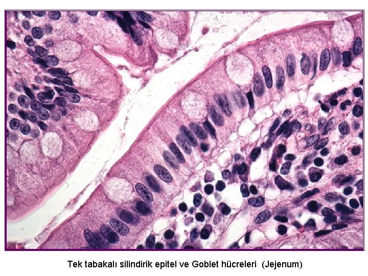 Tek tabakalı silindirik epitel ve Goblet hücreleri (Jejenum) 