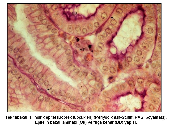 Tek tabakalı silindirik epitel (Böbrek tüpçükleri) (Periyodik asit-Schiff, PAS, boyaması). Epitelin bazal laminası (Ok)