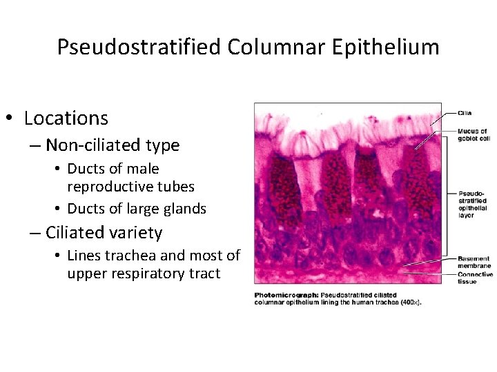 Pseudostratified Columnar Epithelium • Locations – Non-ciliated type • Ducts of male reproductive tubes