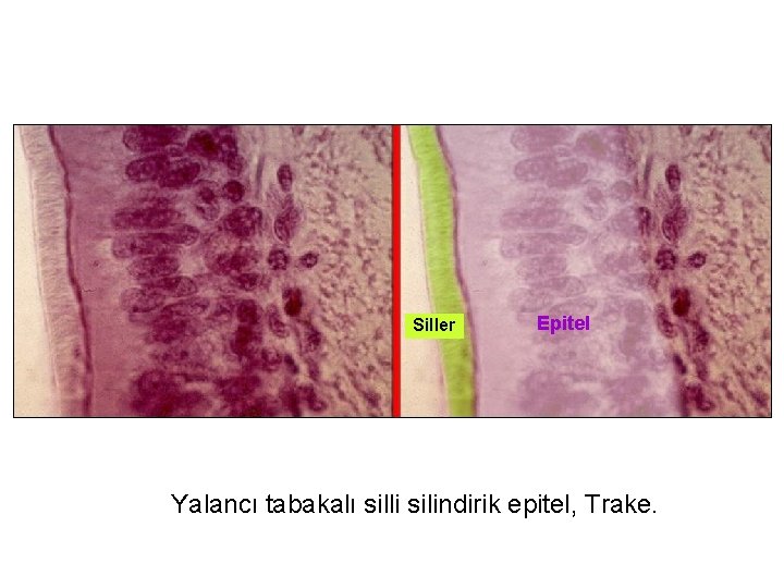 Siller Epitel Yalancı tabakalı silli silindirik epitel, Trake. 