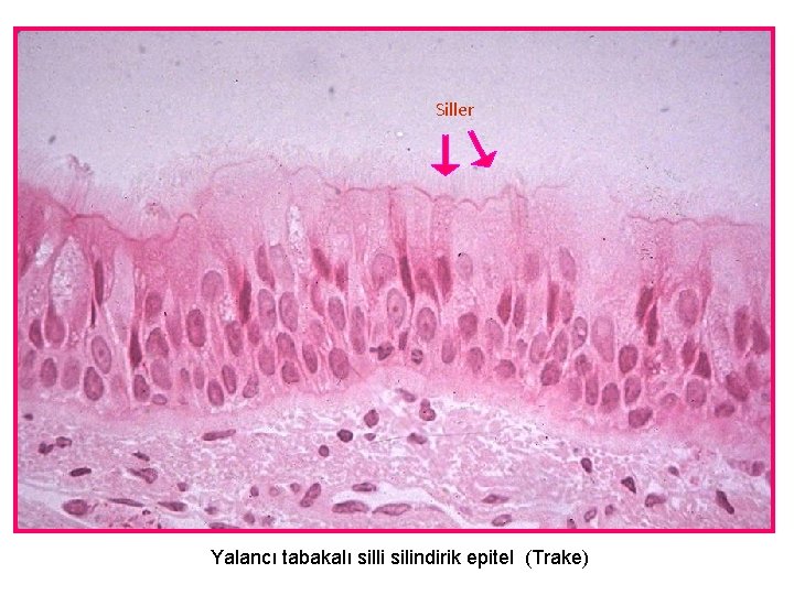 Siller Yalancı tabakalı silli silindirik epitel (Trake) 