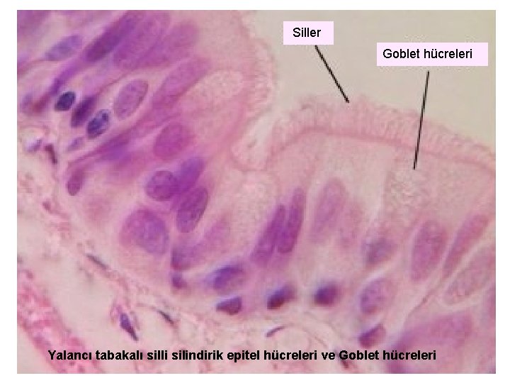 Siller Goblet hücreleri Yalancı tabakalı silli silindirik epitel hücreleri ve Goblet hücreleri 