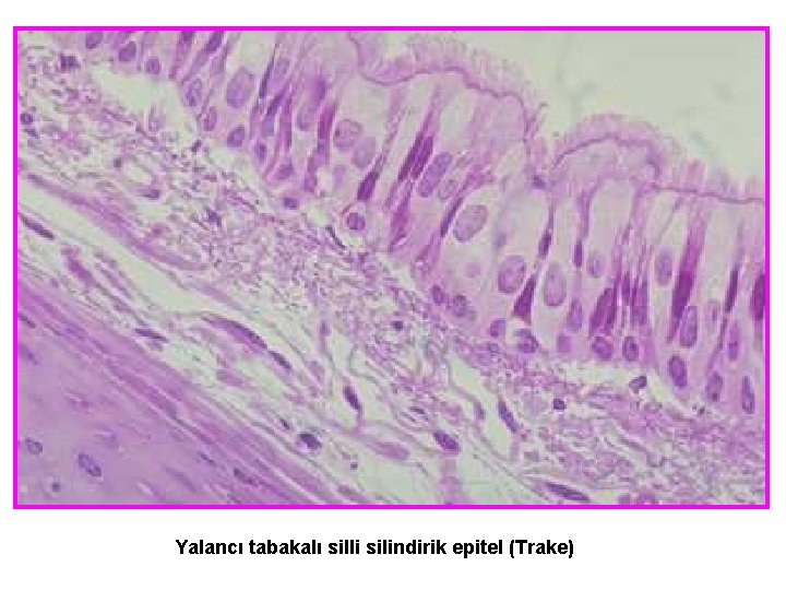 Yalancı tabakalı silli silindirik epitel (Trake) 