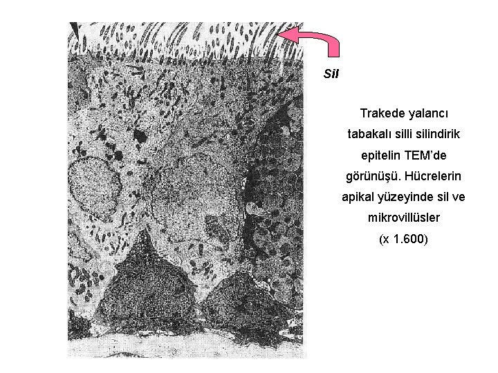 Sil Trakede yalancı tabakalı silli silindirik epitelin TEM’de görünüşü. Hücrelerin apikal yüzeyinde sil ve