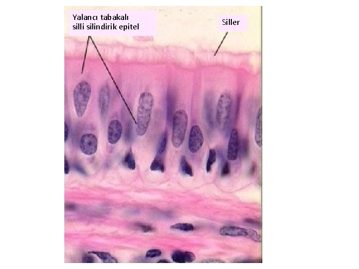 Yalancı tabakalı silli silindirik epitel Siller 