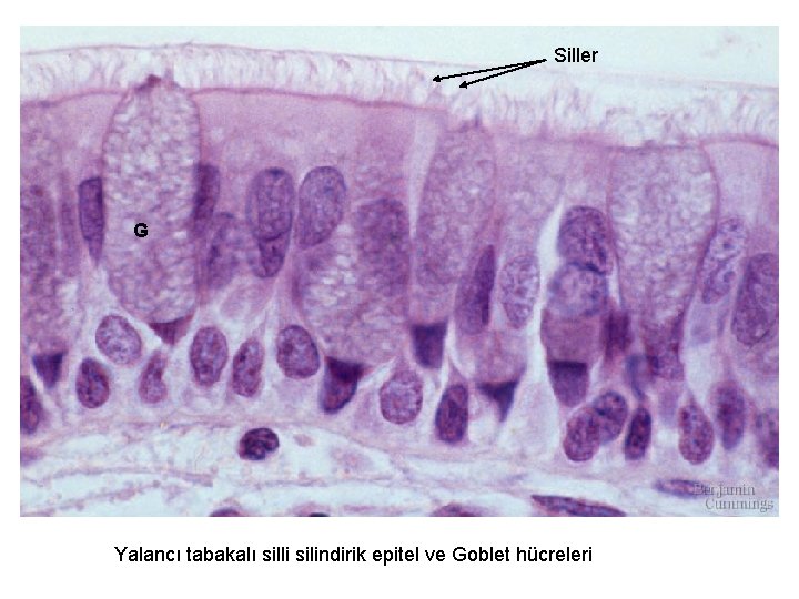 Siller G Yalancı tabakalı silli silindirik epitel ve Goblet hücreleri 