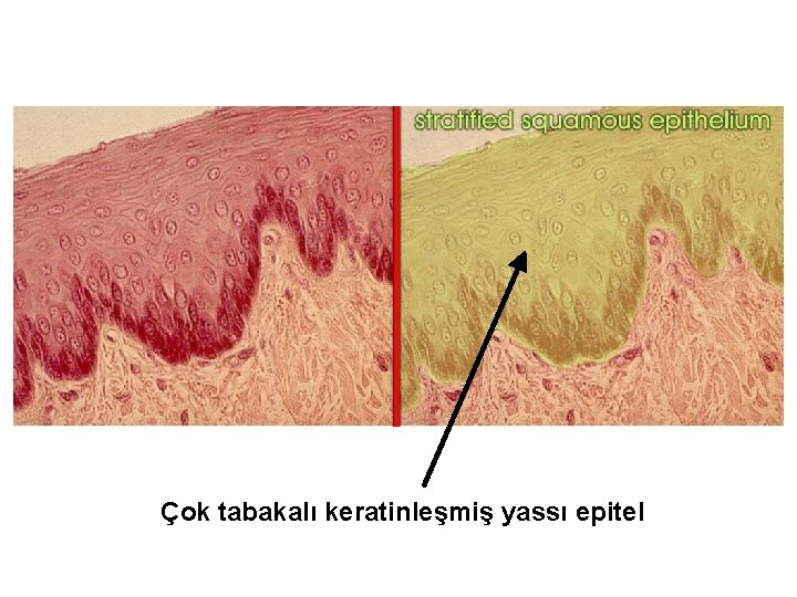 Çok tabakalı keratinleşmiş yassı epitel 