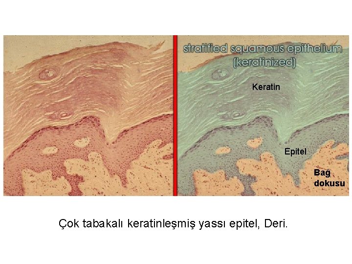 Keratin Epitel Bağ dokusu Çok tabakalı keratinleşmiş yassı epitel, Deri. 